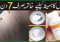 Common Warts Removal Tips, Home Remedies & Treatments
