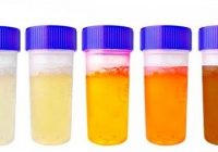 What the Color of Your Urine Can Tell You About Your Health