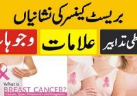 breast cancer causes and prevention