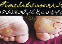 5 How to diagnose the dangerous diseases that are hidden in the feet?