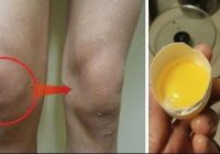 How to Treat Knee Pain: Get Rid of Joint Pain with THIS EGGS Home Remedy