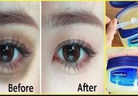 Remove Dark Circles in 3 days with Vaseline Permanently