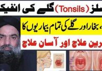 Tonsillitis Infection, Flu, Fever Causes and Treatment at Home