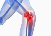 Arthritis Joint Pain, Muscle Pain Causes and Treatment