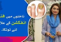 How to treat Nail Fungal Infection