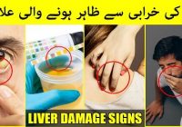 7 Early Signs Of Liver Damage