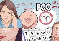 Pcos Signs Symptoms & Treatment