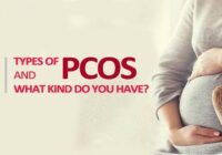What is PCOS and what is its treatment?