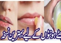 Best Home Remedies To Get RId Of Chapped Lips