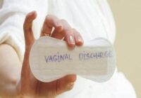 Home remedies for white vaginal discharge in women