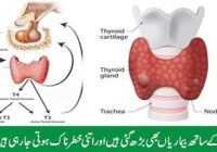 Thyroid disease has increased in women