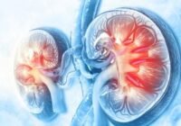 Kidney disease and its symptoms