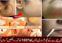 Easy Home Remedies To Get Rid Of Unwanted Facial Hair