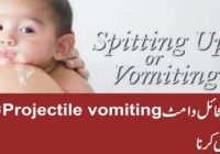 What to Know About Projectile Vomiting in Child