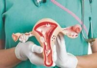 Female infertility, closure of the Fallopian tubes