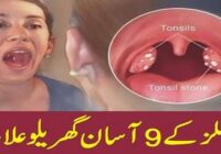 9 Easy Home remedies for tonsils