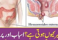 Why does hemorrhoids occur