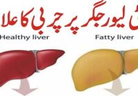 Fatty Liver Fat treatment