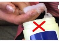 Surprising disadvantages of petroleum jelly used constantly in the cold