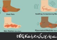 Finding the causes of foot diseases