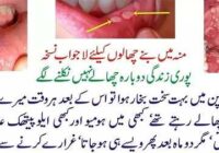 Canker Sores: What to Eat to Beat Mouth Ulcers