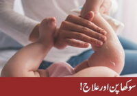 Dryness and treatment of children