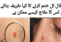 What can cause red dots to appear on the skin