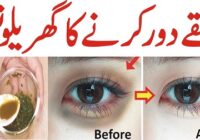 How To Remove Dark Circles Overnight & Powerful Remedy