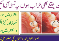 Tooth Cavity Treatment