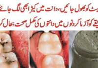 If You Also Get Tooth Decay try This Method