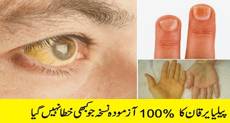 100% Tested and Never Failed Jaundice Jaundice Recipe