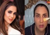 Fiza Ali told which botox mask to make the face beautiful