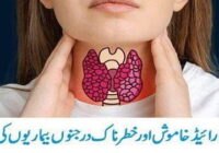 Treatment of Silent And Dangerous Thyroid Disease