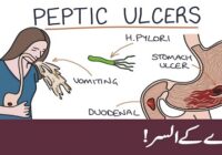 Peptic Ulcer – Symptoms and causes