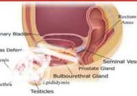 Testosterone and sexual health